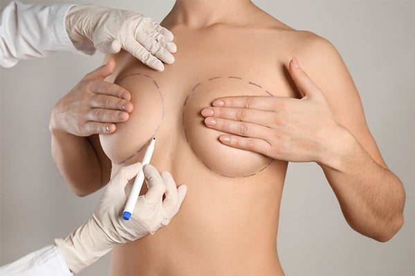 augmentation mammaire par lipofilling graisse paris augmentation mammaire seins chirurgie des seins mammaire paris chirurgien esthetique plasticien paris docteur montoneri augmentation mammaire par lipofilling graisse paris augmentation mammaire seins chirurgie des seins mammaire paris chirurgien esthetique plasticien paris docteur montoneri