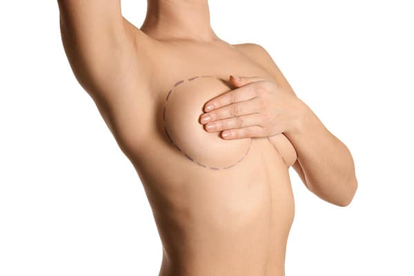 chirurgie esthetique seins paris chirurgie mammaire esthetique paris chirurgien plasticien paris dr sebastiano montoneri chirurgie esthetique seins paris chirurgie mammaire esthetique paris chirurgien plasticien paris dr sebastiano montoneri