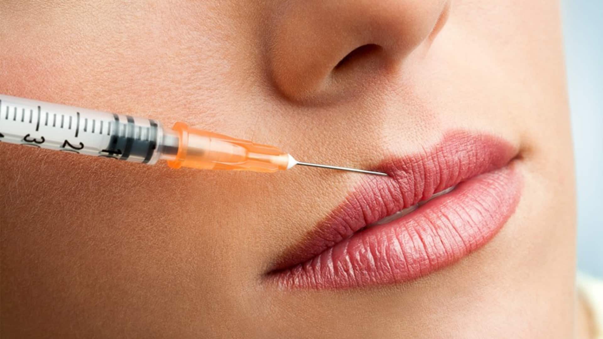 chirurgie levres paris prix injection acide hyaluronique medecine esthetique visage chirurgien esthetique paris dr montoneri