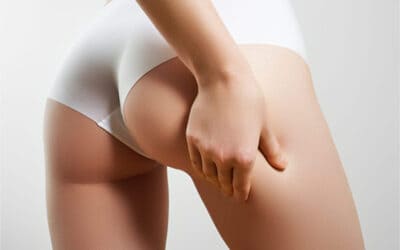 Liposculpture: silhouette sur mesure (lipofilling + liposuccion)