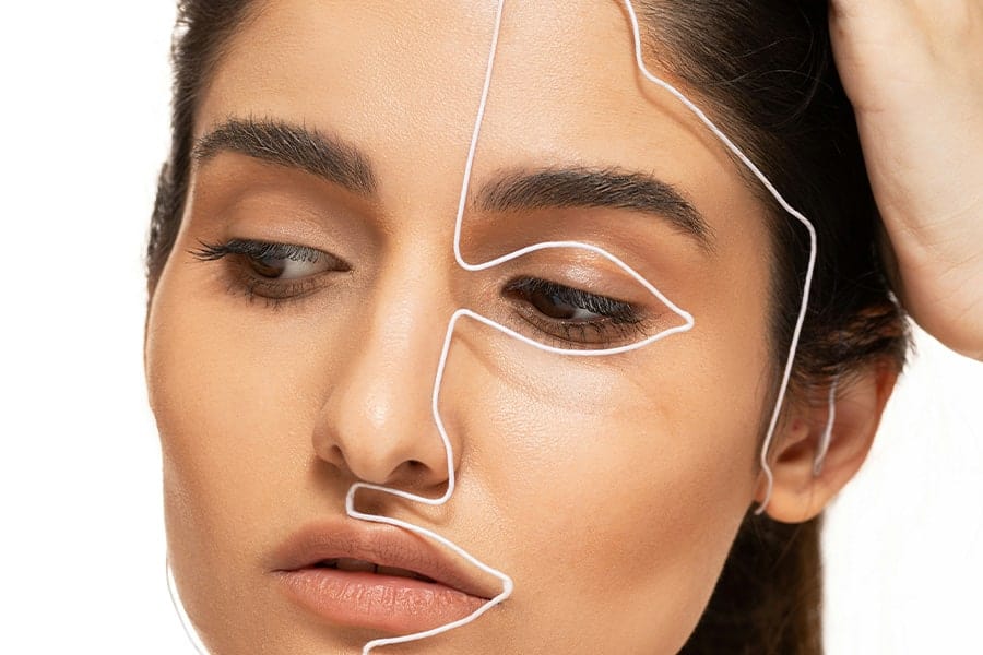 mini lifting visage resultat avant apres chirurgie et medecine esthetique dr sebastiano montoneri chirurgien esthetique paris