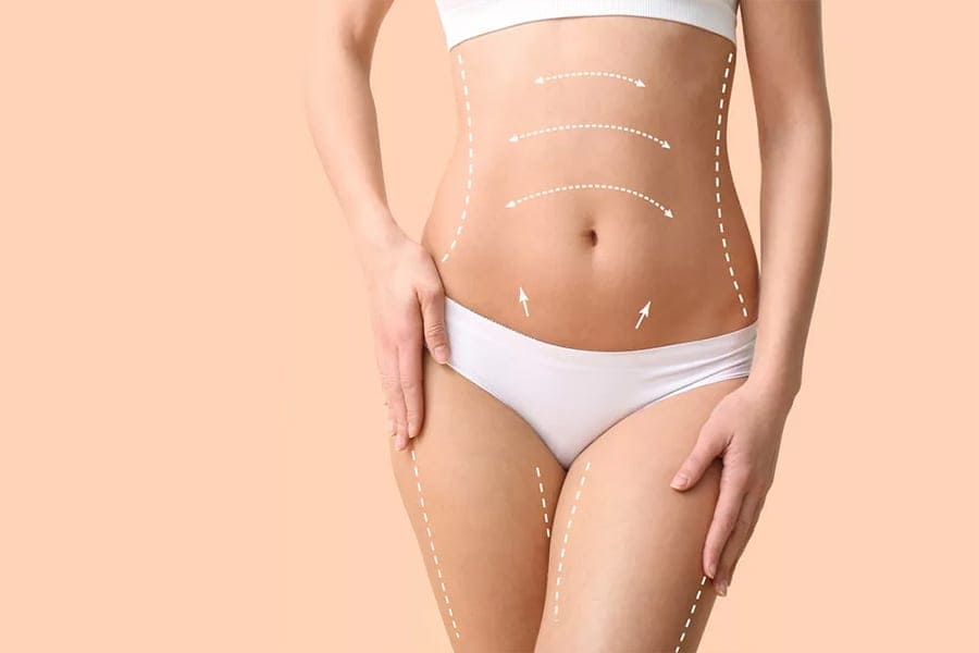 abdominoplastie prise en charge chirurgie et medecine esthetique dr sebastiano montoneri chirurgien esthetique paris abdominoplastie prise en charge chirurgie et medecine esthetique dr sebastiano montoneri chirurgien esthetique paris