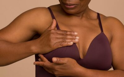 Quelle est l’évolution de la cicatrice après un lifting mammaire ?