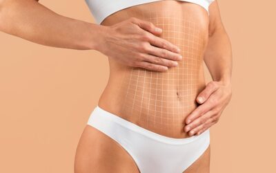 Choisir le meilleur chirurgien pour une abdominoplastie à Paris