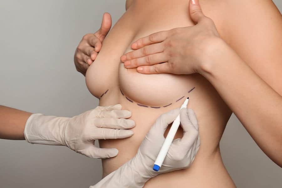 meilleur chirurgien protheses mammaires paris dr sebastiano montoneri chirurgien esthetique paris